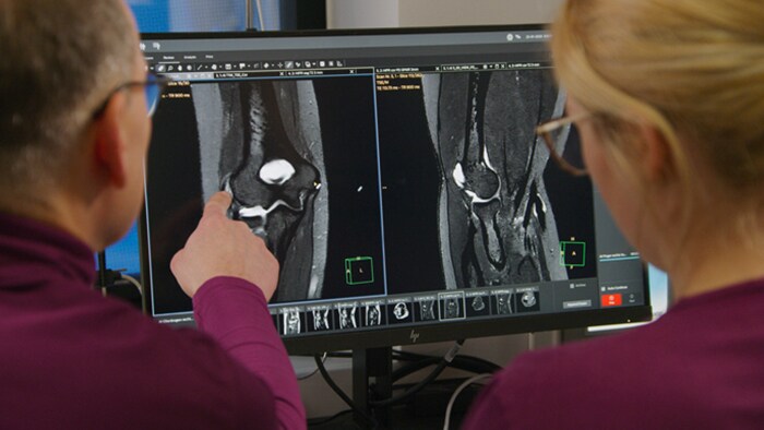 MRI throughput increase and exceptional image quality