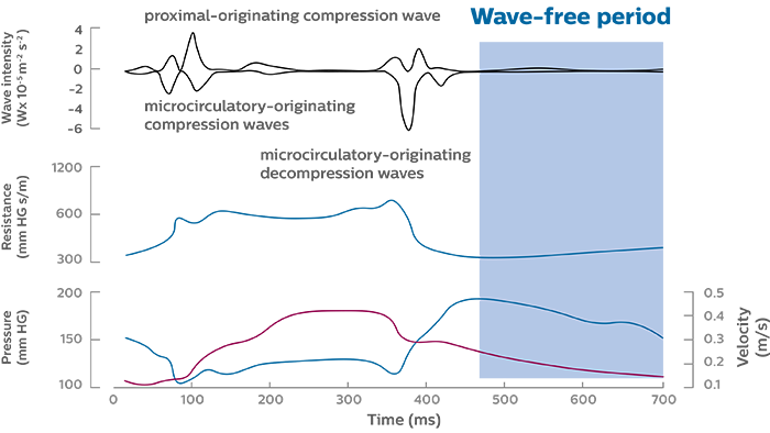 iFR wave-free period graph