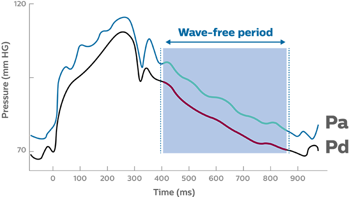 iFR modality wave-free ratio graph
