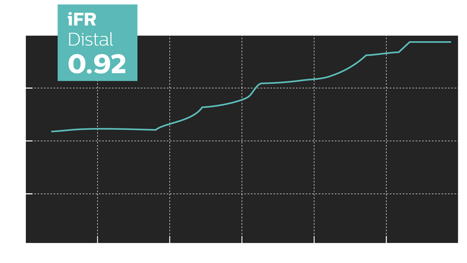 ifr scout post intervention