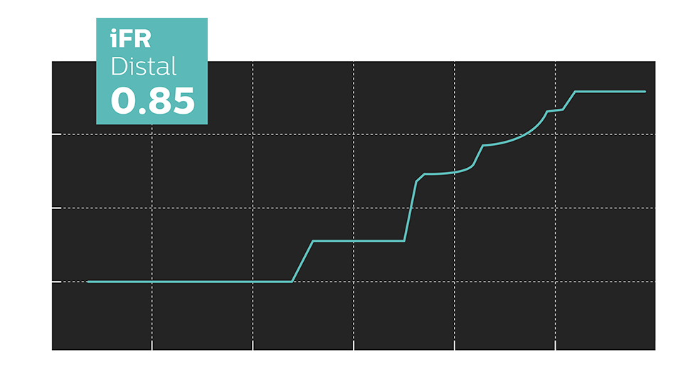 ifr scout pre intervention