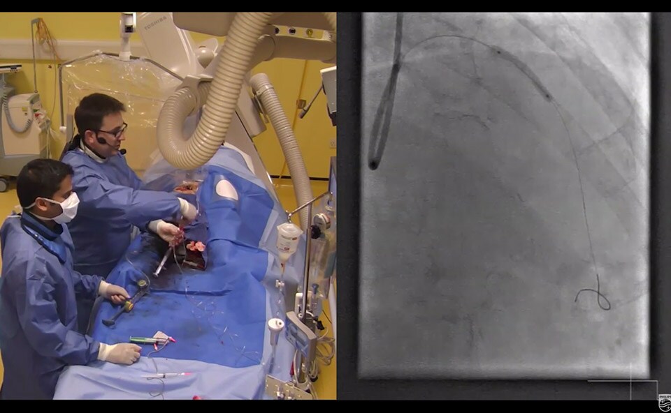 iFR clinical case