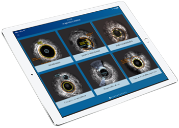 Ivus expertIpad