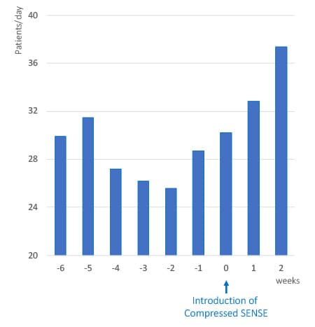 Introduction to Compressed SENSE Statistics