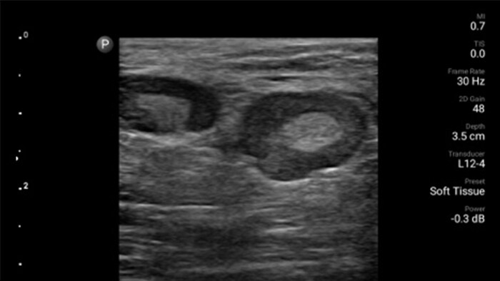 Soft tissue thumbnail