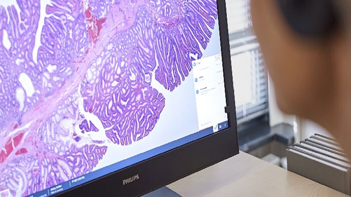 Philips IntelliSite Pathology Solution