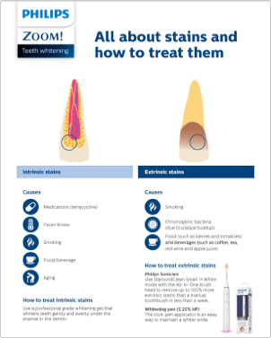 Chairside guide, print version whitening