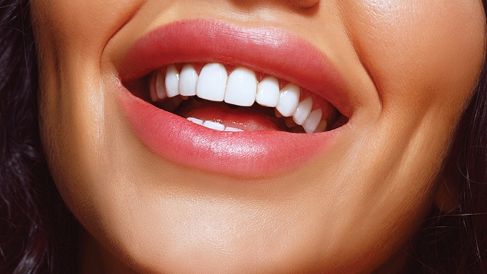 косметического осветления зубов