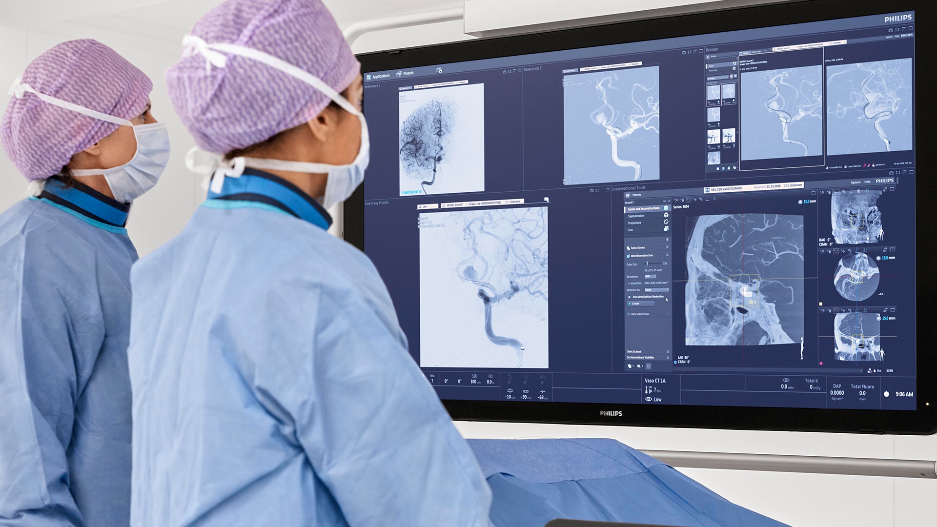 Philips' direct-to-angio stroke pathway: new analysis demonstrates substantial cost savings in addition to improved patient outcomes