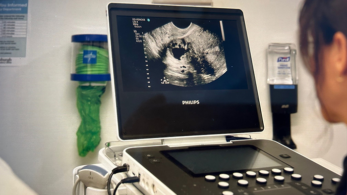 PHILIPS The Pitt Asset 3